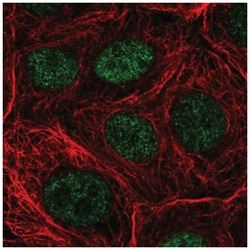 NUDT22 Antibody, Novus Biologicals 25 μL:Antibodies, Polyclonal