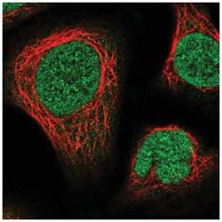 NUP214 Antibody, Novus Biologicals 25 &mu;L, Unlabeled:Antibodies, Polyclonal