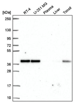 NUP37 Antibody, Novus Biologicals 100 &mu;L | Buy Online | Novus Biologicals | Fisher Scientific
