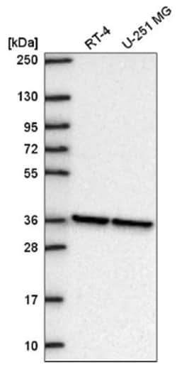 NUP37 Antibody, Novus Biologicals 100&mu;L; Unlabeled:Antibodies, Polyclonal