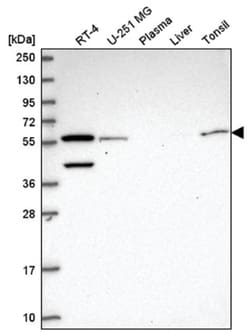 NUP50 Antibody, Novus Biologicals 100&mu;L; Unlabeled:Antibodies, Polyclonal