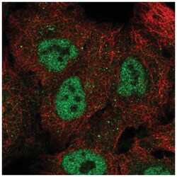 NUP98 Antibody, Novus Biologicals 25 &mu;L, Unlabeled:Antibodies, Polyclonal