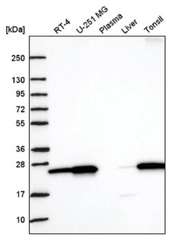 Nurim Antibody, Novus Biologicals 100&mu;L; Unlabeled:Antibodies, Polyclonal