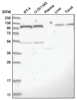 O-GlcNAc Transferase p110 subunit Antibody, Novus Biologicals:Antibodies:Primary