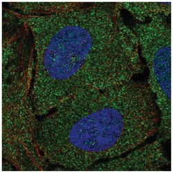 O-GlcNAcase/OGA/MGEA5 Antibody, Novus Biologicals 25 &mu;L, Unlabeled:Antibodies,