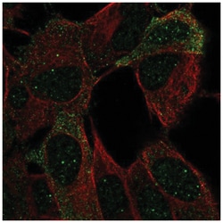 OCAM/NCAM2 Antibody, Novus Biologicals:Antibodies:Primary Antibodies