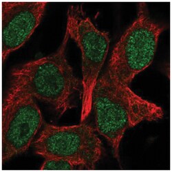 Ocular development associated gene Antibody, Novus Biologicals:Antibodies:Primary