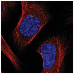 ODF2 Antibody, Novus Biologicals 100&mu;L; Unlabeled:Antibodies, Polyclonal