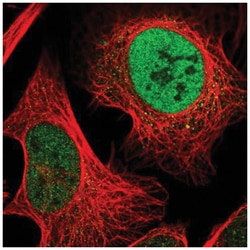 ODR4/TTG1 Antibody, Novus Biologicals 100&mu;L; Unlabeled:Antibodies, Polyclonal