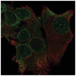 OIP106 Antibody, Novus Biologicals 25 &mu;L:Antibodies, Polyclonal