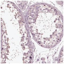 Opticin Antibody, Novus Biologicals:Antibodies:Primary Antibodies