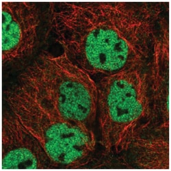 ORAOV1 Antibody, Novus Biologicals 100&mu;L; Unlabeled:Antibodies, Polyclonal