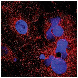 Human ORM2 Antibody (Clone 959445), R D Systems:Antibodies:Primary Antibodies