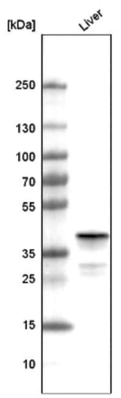 Ornithine Carbamoyltransferase Antibody (CL4045), Novus Biologicals:Antibodies:Primary