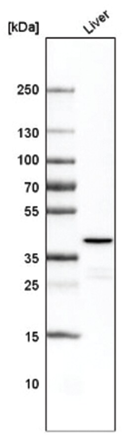 Ornithine Carbamoyltransferase Antibody (CL4049), Novus Biologicals:Antibodies:Primary