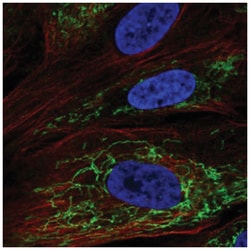 OSAP Antibody, Novus Biologicals 100&mu;L; Unlabeled:Antibodies, Polyclonal
