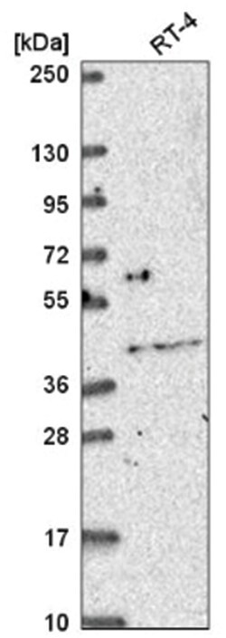OSR2 Antibody, Novus Biologicals 25 &mu;L, Unlabeled:Antibodies, Polyclonal