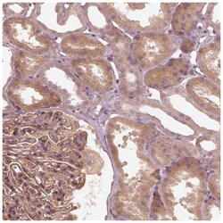 OTOGL Antibody, Novus Biologicals 25 &mu;L:Antibodies, Polyclonal
