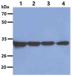 Otubain-1 Mouse anti-Human, Clone: 1.70E+11, Novus Biologicals 100&mu;L;