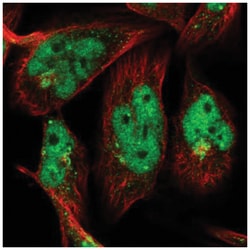 OTUD1 Antibody, Novus Biologicals 100&mu;L; Unlabeled:Antibodies, Polyclonal