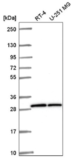OVCA2 Antibody, Novus Biologicals 100&mu;L; Unlabeled:Antibodies, Polyclonal
