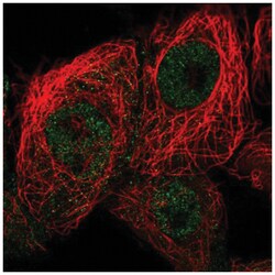 p19 INK4d Antibody, Novus Biologicals 100&mu;L; Unlabeled:Antibodies, Polyclonal