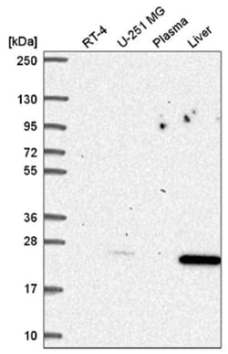 p27/Kip1 Antibody, Novus Biologicals 100&mu;L; Unlabeled:Antibodies, Polyclonal