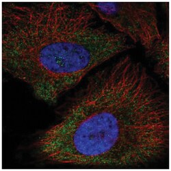 P2X5/P2RX5 Antibody, Novus Biologicals 25 &mu;L, Unlabeled:Antibodies,