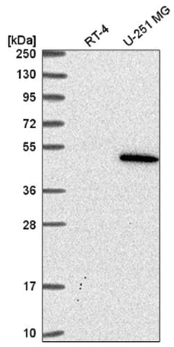 p53 Antibody, Novus Biologicals:Antibodies:Primary Antibodies