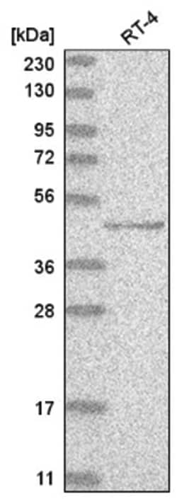 p73 Antibody, Novus Biologicals 100&mu;L; Unlabeled:Antibodies, Polyclonal