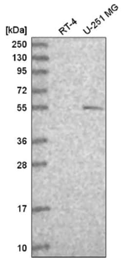 p73 Antibody, Novus Biologicals 100&mu;L; Unlabeled:Antibodies, Polyclonal