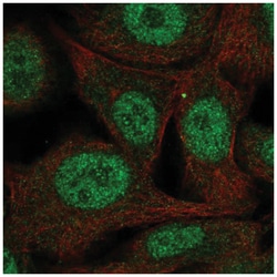 PAAF1 Antibody, Novus Biologicals 100&mu;L; Unlabeled:Antibodies, Polyclonal