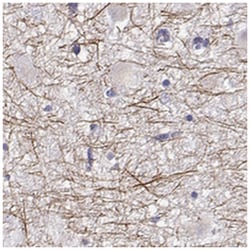 PABPC1L2A Antibody, Novus Biologicals:Antibodies:Primary Antibodies