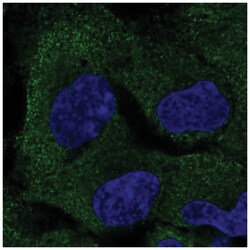 PAIP2B Antibody, Novus Biologicals:Antibodies:Primary Antibodies