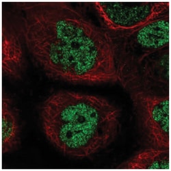 PALB2 Antibody, Novus Biologicals 100&mu;L; Unlabeled:Antibodies, Polyclonal