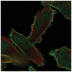 PALM2 Antibody, Novus Biologicals:Antibodies:Primary Antibodies