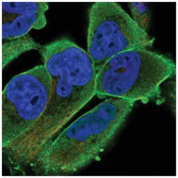 PALMD Antibody, Novus Biologicals 25 &mu;L; Unconjugated:Antibodies, Polyclonal