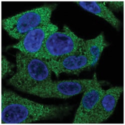 PAP39 Antibody, Novus Biologicals:Antibodies:Primary Antibodies