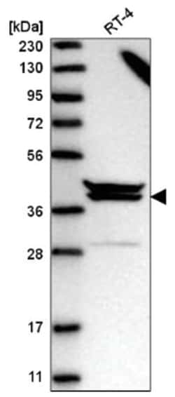 PAPOLG Antibody, Novus Biologicals 100&mu;L; Unlabeled:Antibodies, Polyclonal