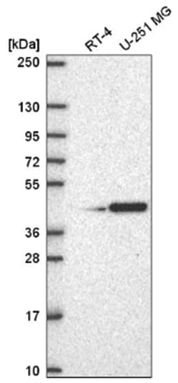 PAQR6 Antibody, Novus Biologicals 25 &mu;L, Unlabeled:Antibodies, Polyclonal