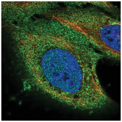 PAQR8 Antibody, Novus Biologicals 100&mu;L; Unlabeled:Antibodies, Polyclonal