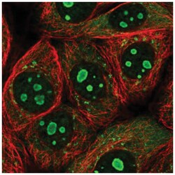 PARP10 Antibody, Novus Biologicals:Antibodies:Primary Antibodies