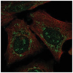 PARS2 Antibody, Novus Biologicals:Antibodies:Primary Antibodies