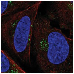 Patched 1/PTCH Antibody, Novus Biologicals 25 &mu;L, Unlabeled:Antibodies,
