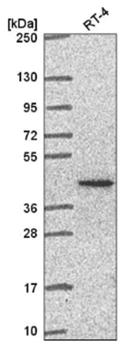 PCBP1 Antibody, Novus Biologicals 25 &mu;L, Unlabeled:Anticuerpos