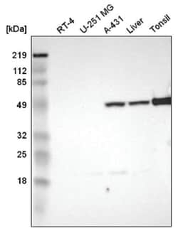 PD-ECGF/Thymidine Phosphorylase Antibody, Novus Biologicals 25 &mu;L | Buy Online | Novus Biologicals | Fisher Scientific