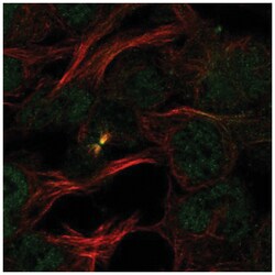 PDCD2 Antibody, Novus Biologicals 25 &mu;L, Unlabeled:Antibodies, Polyclonal