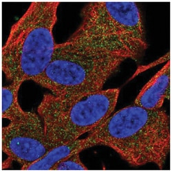 PDE6 beta Antibody, Novus Biologicals 25 &mu;L:Antibodies, Polyclonal