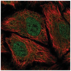 PDE8B Antibody, Novus Biologicals 25 &mu;L, Unlabeled:Antibodies, Polyclonal