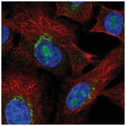 PDGFRL Antibody, Novus Biologicals 25 &mu;L, Unlabeled:Antibodies, Polyclonal